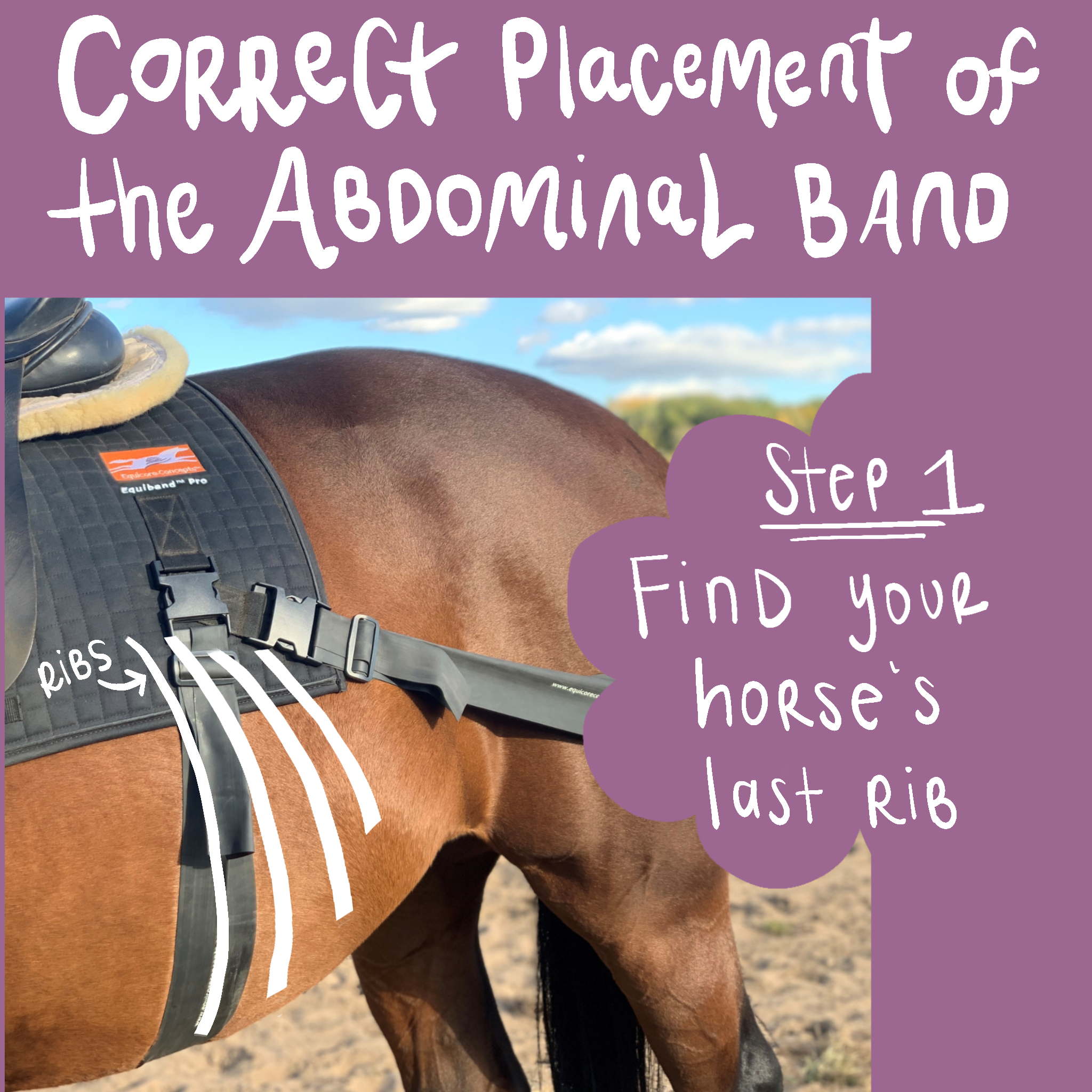 abdominal-band-placement-1